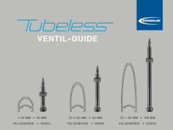 Schwalbe Tubeless Sibop Seti 40mm Uzunluk - 2